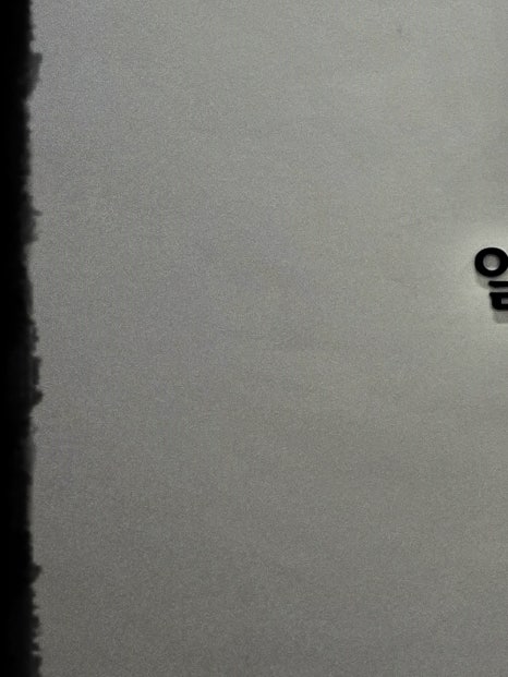 홍대 보톡스, 아름다운 라인을 만들고 싶다면 관련 이미지 11