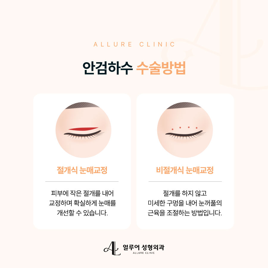 홍대 안검하수 졸려보이는 눈이 스트레스라면 관련 이미지 3