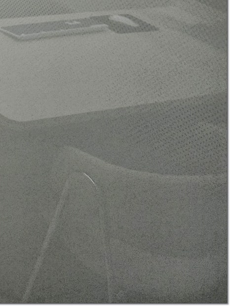 서교동 성형외과 효과 좋은 리프팅을 원한다면? 관련 이미지 25