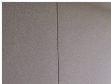 홍대입구역 스킨부스터로 빛나는 피부를! 관련 이미지 8