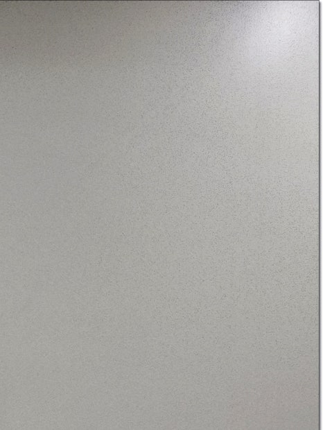 서교동 성형외과 효과 좋은 리프팅을 원한다면? 관련 이미지 10