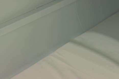 홍대쌍커풀수술 나에게 맞는 눈성형은? 관련 이미지 21
