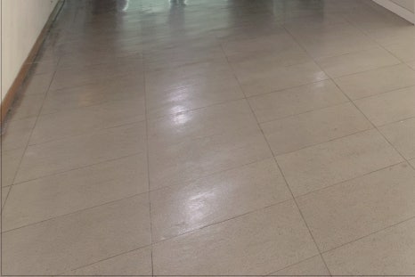 홍대 턱필러로 예쁜 얼굴라인을 관련 이미지 23
