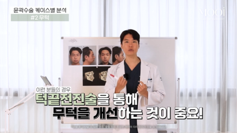 무턱, 턱끝 전진만으로 입체감이 생길까? 턱끝수술 실제 케이스 분석 관련 이미지 7