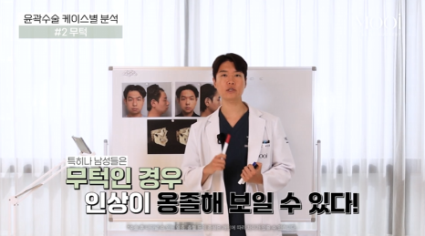 무턱, 턱끝 전진만으로 입체감이 생길까? 턱끝수술 실제 케이스 분석 관련 이미지 6