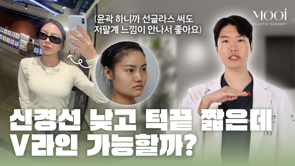 무턱, 이중턱 짧은 턱끝, 턱끝성형으로 V라인 만드는 법 관련 이미지 1