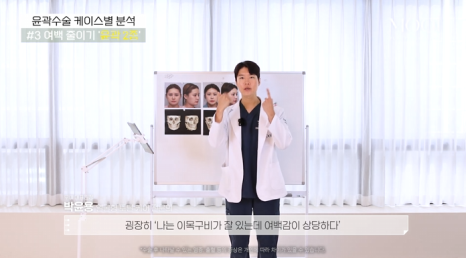 윤곽 2종 3종 차이, 얼굴 여백 줄이기 총정리 관련 이미지 2