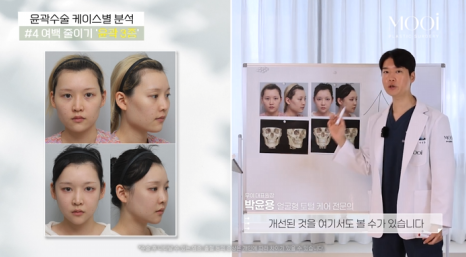 윤곽 2종 3종 차이, 얼굴 여백 줄이기 총정리 관련 이미지 10