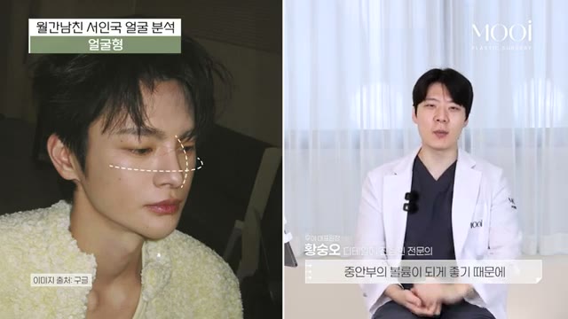 서인국 얼굴 분석, 조화로운 남자 인상의 기준은? (눈,코,티존 분석) 관련 이미지 3