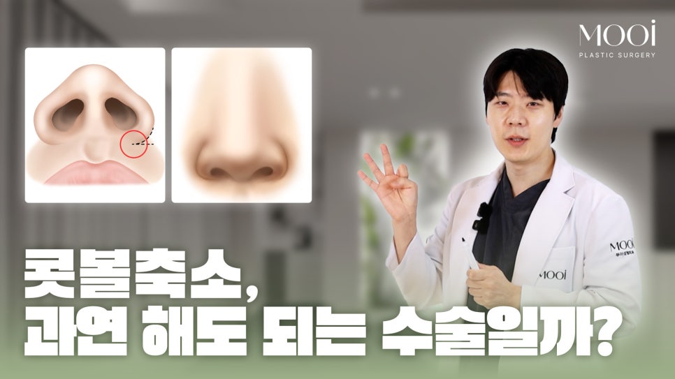 콧볼축소 하면 안 되는 수술일까? 부자연스러워지는 진짜 이유와 핵심 관련 이미지 1