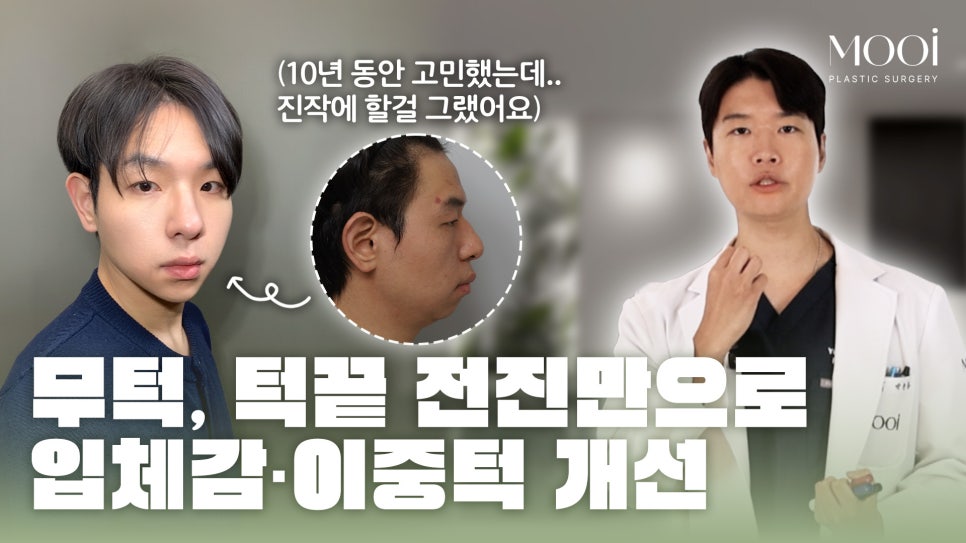 무턱, 턱끝 전진만으로 입체감이 생길까? 턱끝수술 실제 케이스 분석 관련 이미지 1