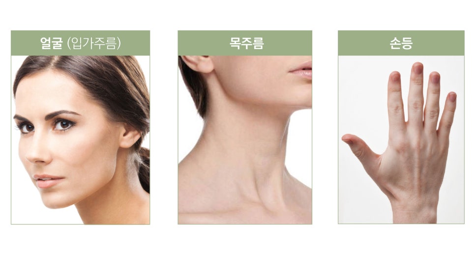 Gangnam Station Radiesse - Filling the Core image 9