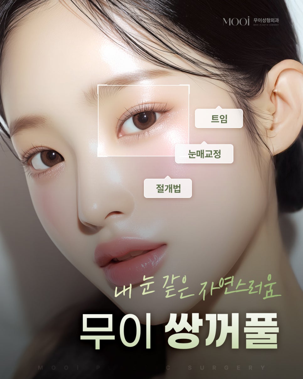 Customized Eye Surgery Tips: Incision, Non-Incision, Canthoplasty, and Ptosis Correction Tailored to Your Eyes image 1