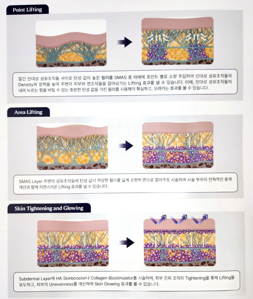 필러로 리프팅이 될까? 레스틸렌 지플랜 필러리프팅 총정리 관련 이미지 6