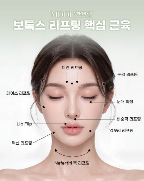 Everything You Need to Know About Botox Lifting: Defining the Jawline and Neckline image 3
