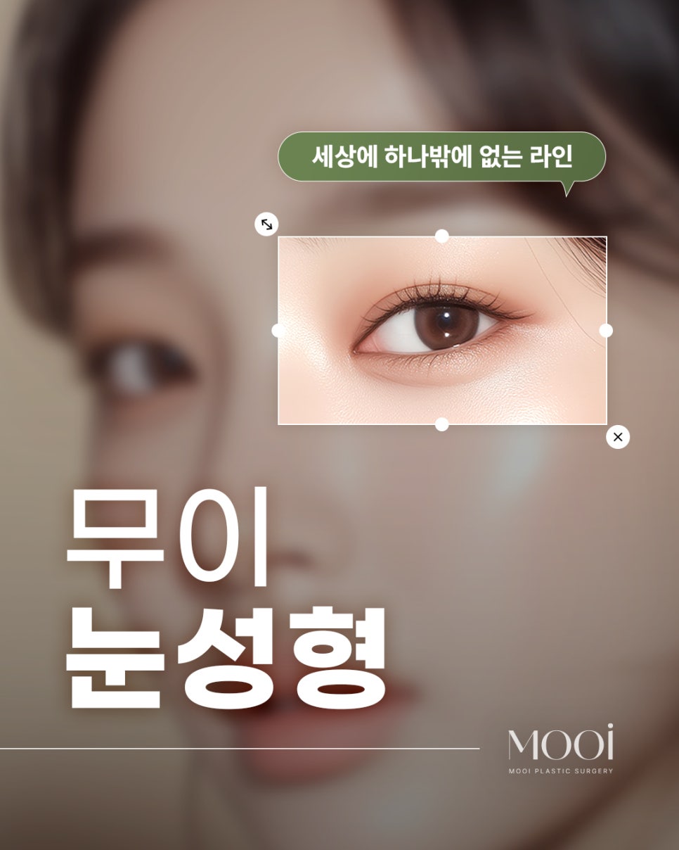 If the inner corner of your eyes feels cramped, consider this instead of Mongolian fold removal image 1