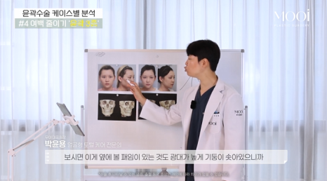 윤곽 2종 3종 차이, 얼굴 여백 줄이기 총정리 관련 이미지 9