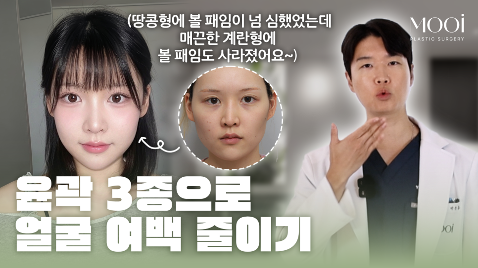 윤곽 2종 3종 차이, 얼굴 여백 줄이기 총정리 관련 이미지 1