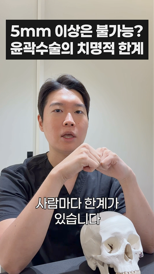 무이성형외과 5mm 이상은 불가능? 윤곽수술의 치명적 한계 관련 이미지 12