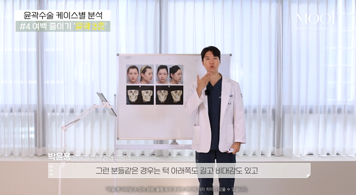 윤곽 2종 3종 차이, 얼굴 여백 줄이기 총정리 관련 이미지 6