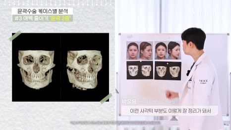 윤곽 2종 3종 차이, 얼굴 여백 줄이기 총정리 관련 이미지 4