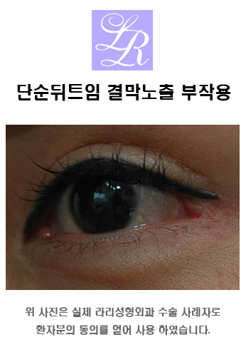 Lateral Canthoplasty Restoration - When Is the Reconstruction Timing Before and After Revision Surgery? image 1