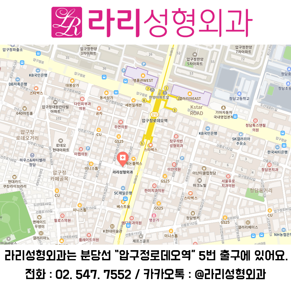 자연으로 생긴 여러겹 쌍꺼풀 없애는 수술 (수술한적 없는 눈) 관련 이미지 2