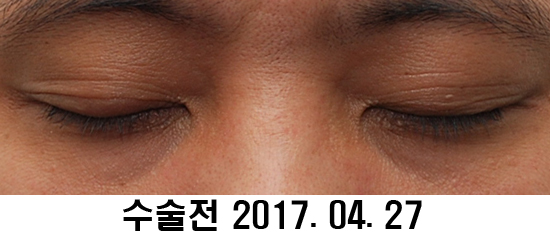 Before and After: Sharper Male Eye Correction (feat. Video) image 10