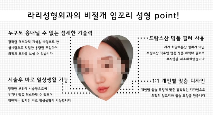 How to Make the Corners of the Mouth Lift Beautifully with Lip Corner Filler image 4