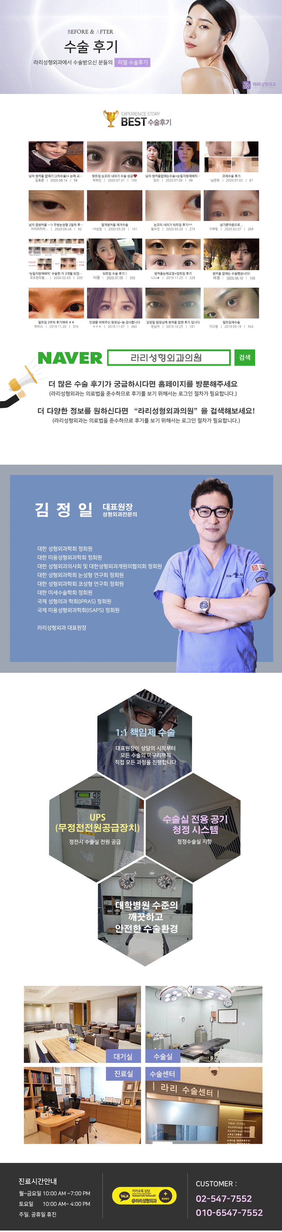 눈앞쪽 여러겹 쌍거풀없애기+뾰족한누호 둥글게 만들기 관련 이미지 7