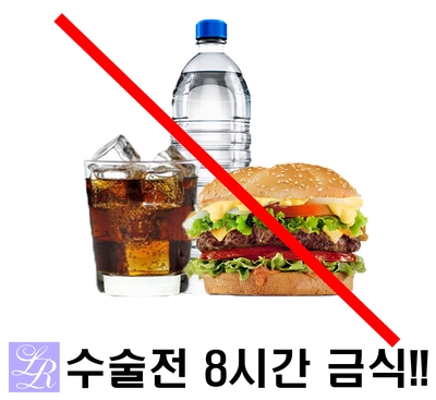쌍꺼풀수술 전 & 쌍꺼풀수술 후 주의사항 관련 이미지 1