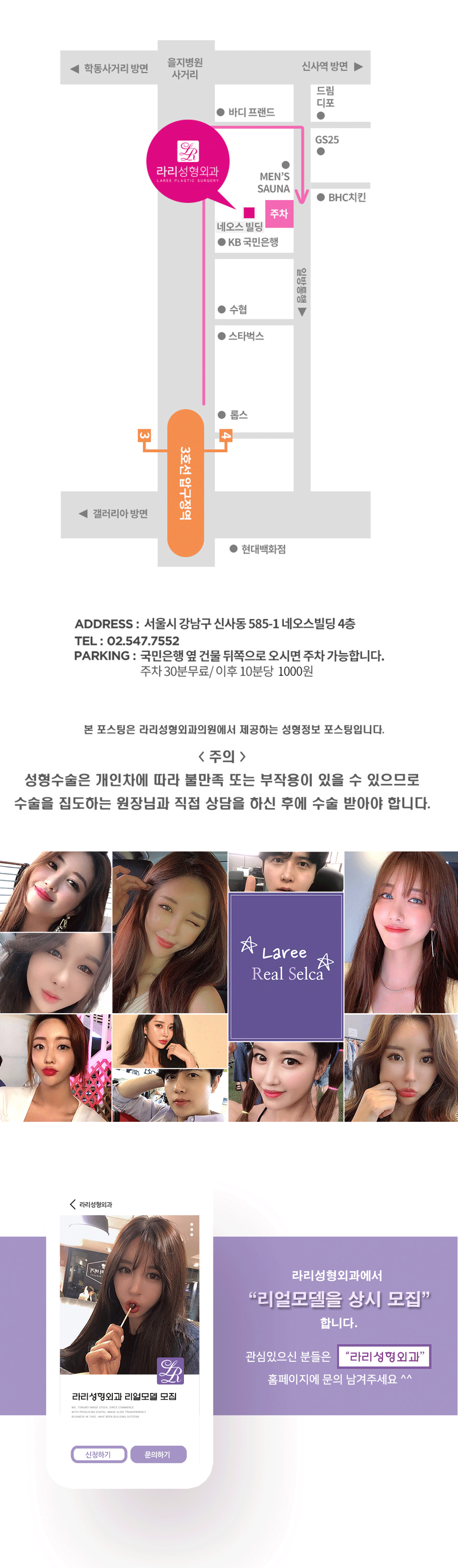 뒷트임재수술, 눈밑지방재배치 콜라보 관련 이미지 6