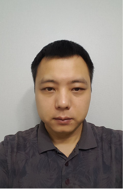 쌍꺼풀없애기 "나 대세임? " 관련 이미지 7