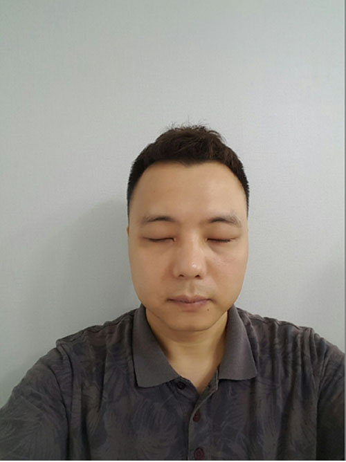 쌍꺼풀없애기 "나 대세임? " 관련 이미지 10