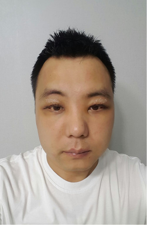 쌍꺼풀없애기 "나 대세임? " 관련 이미지 4