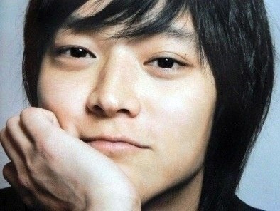 [라리성형외과]  한쪽만 진한 자연쌍꺼풀, 쌍꺼풀없애기 양쪽 다 수술한 전후사진 관련 이미지 1