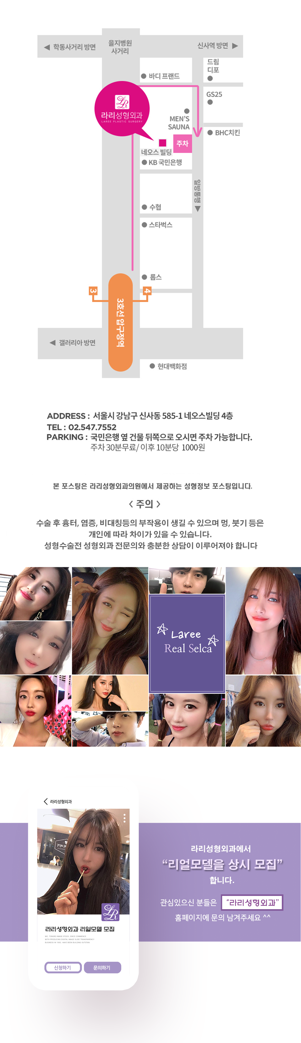 [라리성형외과] 효과 확실한 눈꼬리내리기뒤트임수술 단기 경과 전후 사진 관련 이미지 5