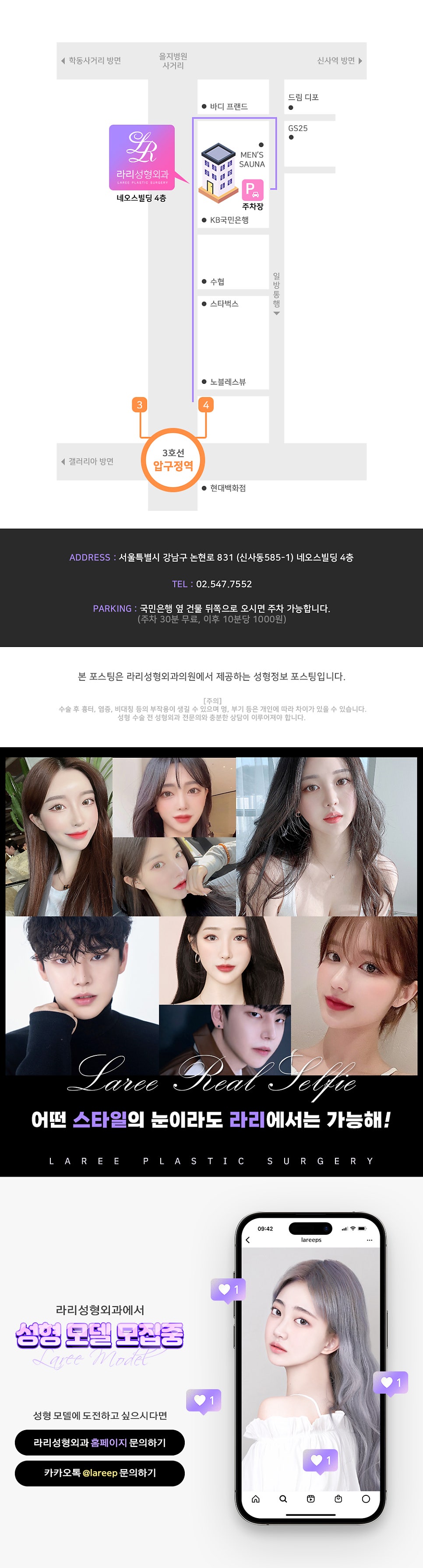 [라리성형외과] 여러겹 두꺼운 자연 쌍꺼풀 무쌍으로 풀기, 없애는 수술 관련 이미지 10