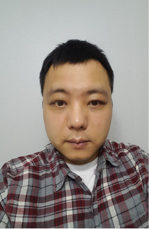 쌍꺼풀없애기 "나 대세임? " 관련 이미지 6