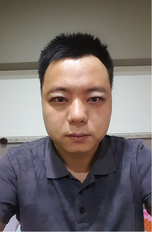 쌍꺼풀없애기 "나 대세임? " 관련 이미지 3