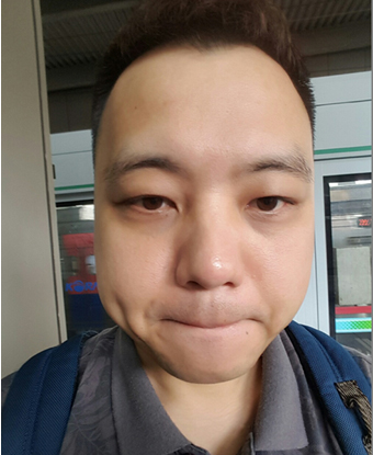 쌍꺼풀없애기 "나 대세임? " 관련 이미지 12