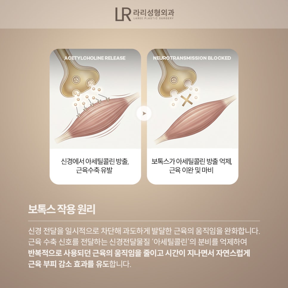 [라리성형외과] 보톡스, 알고 맞아야 제대로 효과를 볼 수 있습니다. (+부작용, 주의사항) 관련 이미지 1