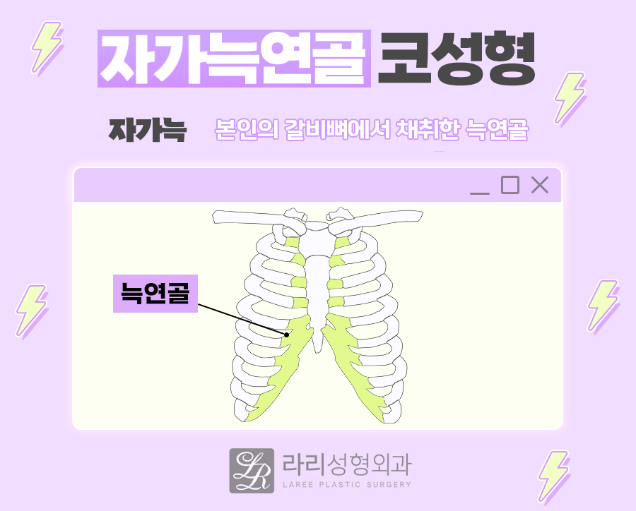 [라리성형외과] 자가늑연골을 이용한 여러 가지 코 수술 : 고난이도 코성형의 핵심 재료 관련 이미지 1