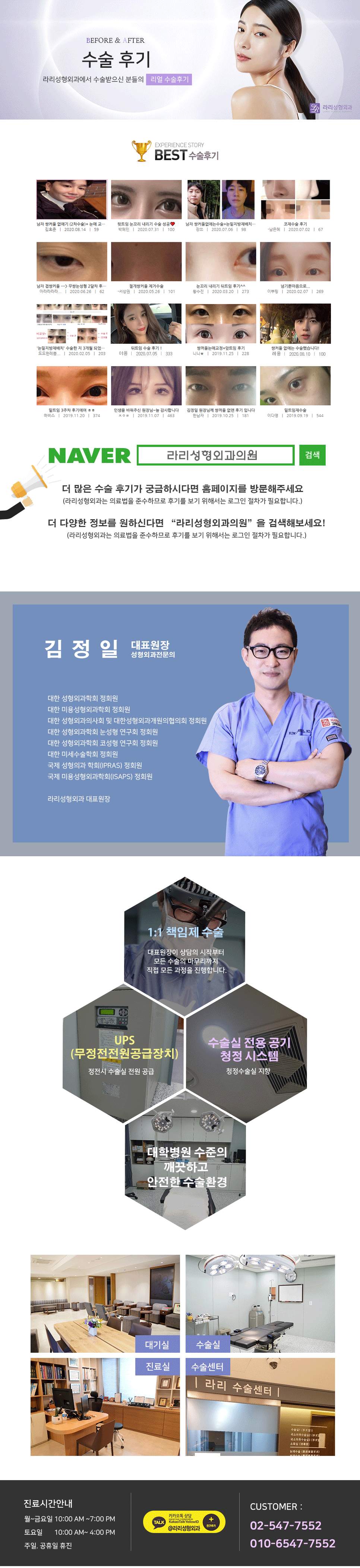 [라리성형외과] 효과 확실한 눈꼬리내리기뒤트임수술 단기 경과 전후 사진 관련 이미지 4