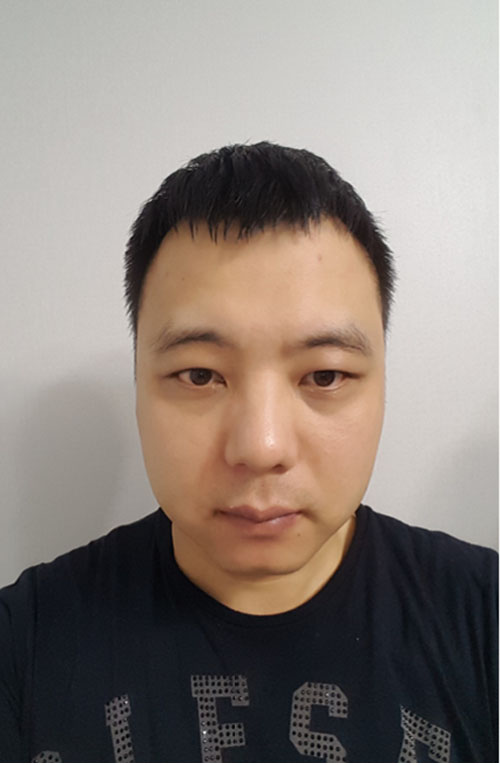 쌍꺼풀없애기 "나 대세임? " 관련 이미지 8