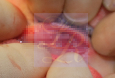 If You Want an S-Line Under Your Eyes, Try Lower Eye Widening image 6