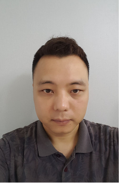 쌍꺼풀없애기 "나 대세임? " 관련 이미지 9