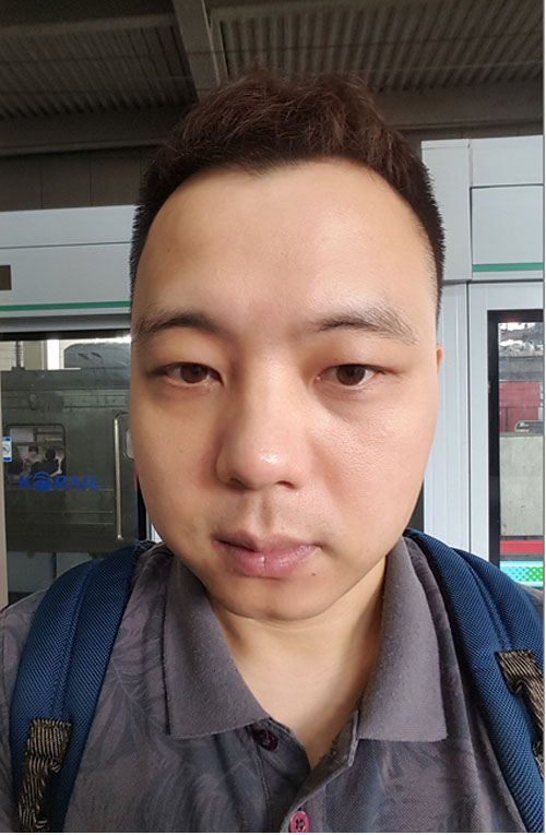 쌍꺼풀없애기 "나 대세임? " 관련 이미지 11