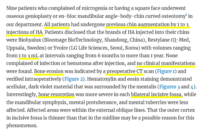 “Filler Side Effects? Characteristics? You Really Need to Be Careful with Fillers. A Plastic Surgeon Personally Sees Filler Side Effects” A Close Analysis of the Bone Depression Controversy in the Video! (feat. Chinese Paper) - 2 image 5