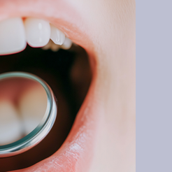 역삼동치과 잇몸고름주머니 방치하면 위험한 이유 원인부터 치료까지 관련 이미지 13